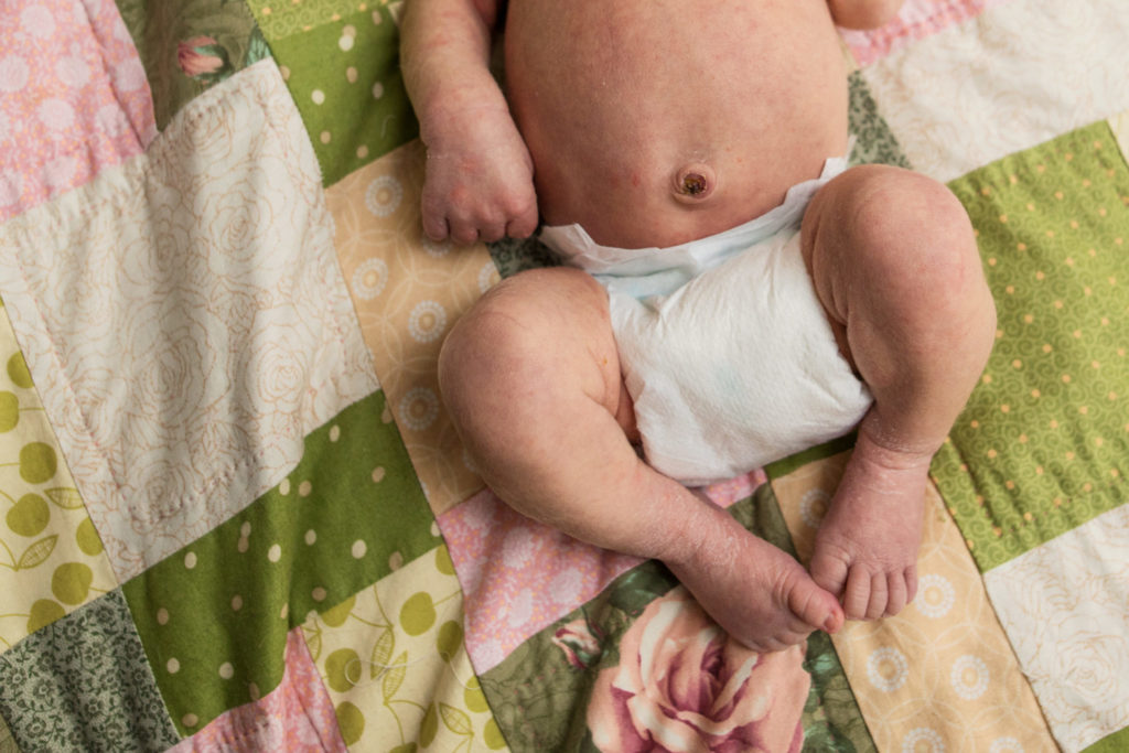 newborn-in-diaper-boston-newborn-photography